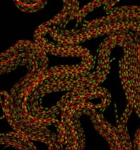 Células de Bacillus subtilis forçadas a produzir a proteína MciZ não conseguem se dividir e se transformam em longos filamentos multinucleados. A cor vermelha representa a membrana celular e a verde, o DNA bacteriano (divulgação)