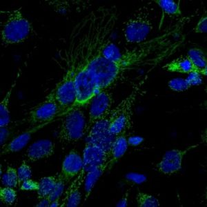 Células de tumor possuem metabolismo exacerbado, aqui exemplificado pela localização de glutaminase C na extensa rede de mitocôndrias (em verde). As mitocôndrias são as fornalhas geradoras de energia para as células. Em azul, os núcleos celulares (Crédito: LNBio/CNPEM)