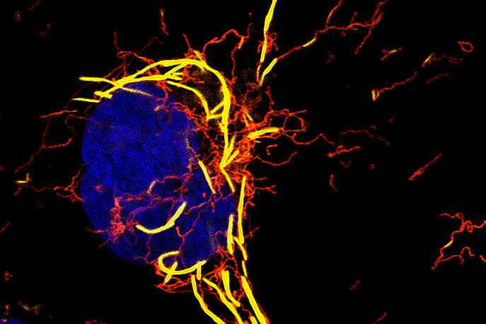 ImageJ=1.54funit=micron