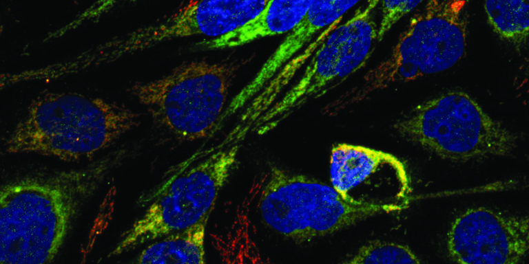 noticia bolsa pos doc_cancer de mama.tif (RGB) min